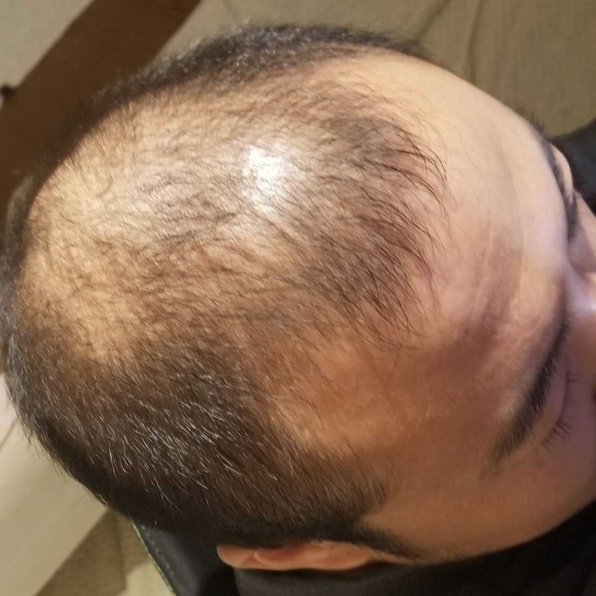 レス6番の画像5