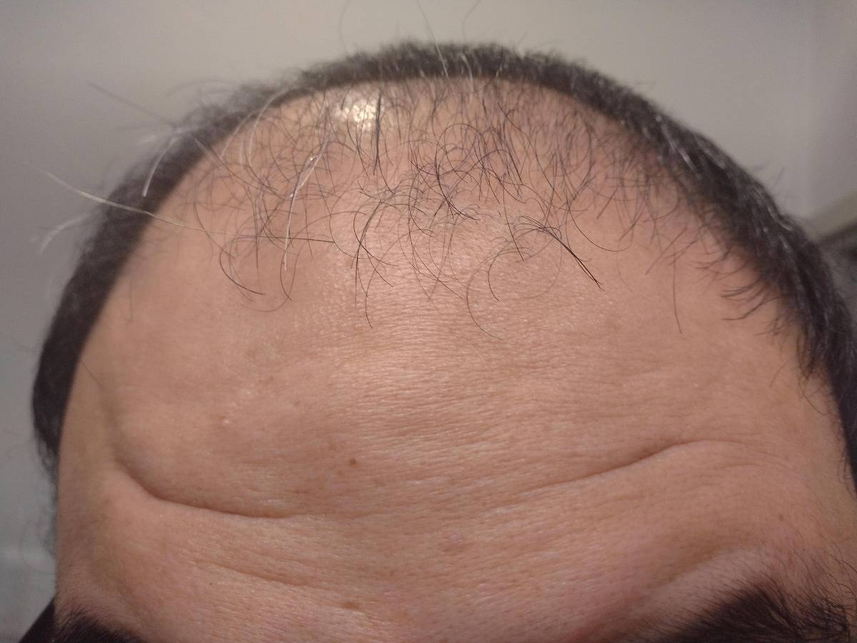 レス3番の画像1