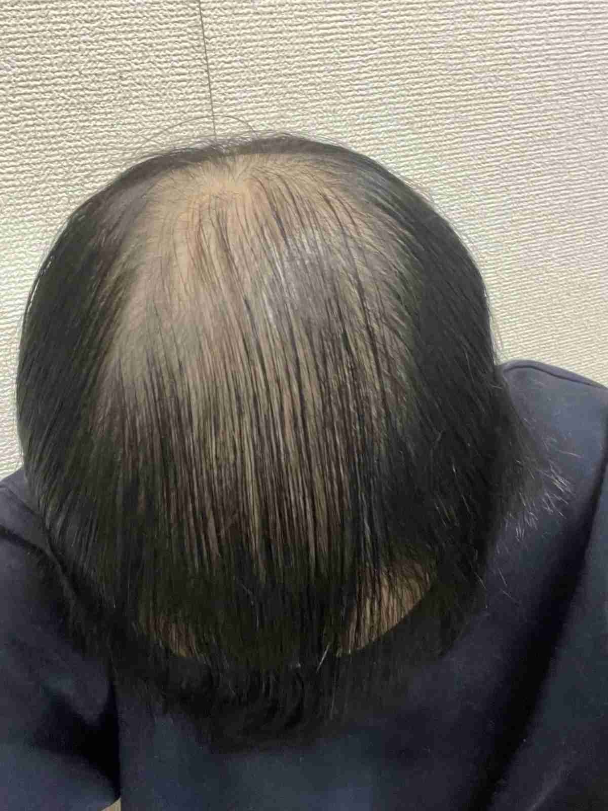 レス2番の画像1