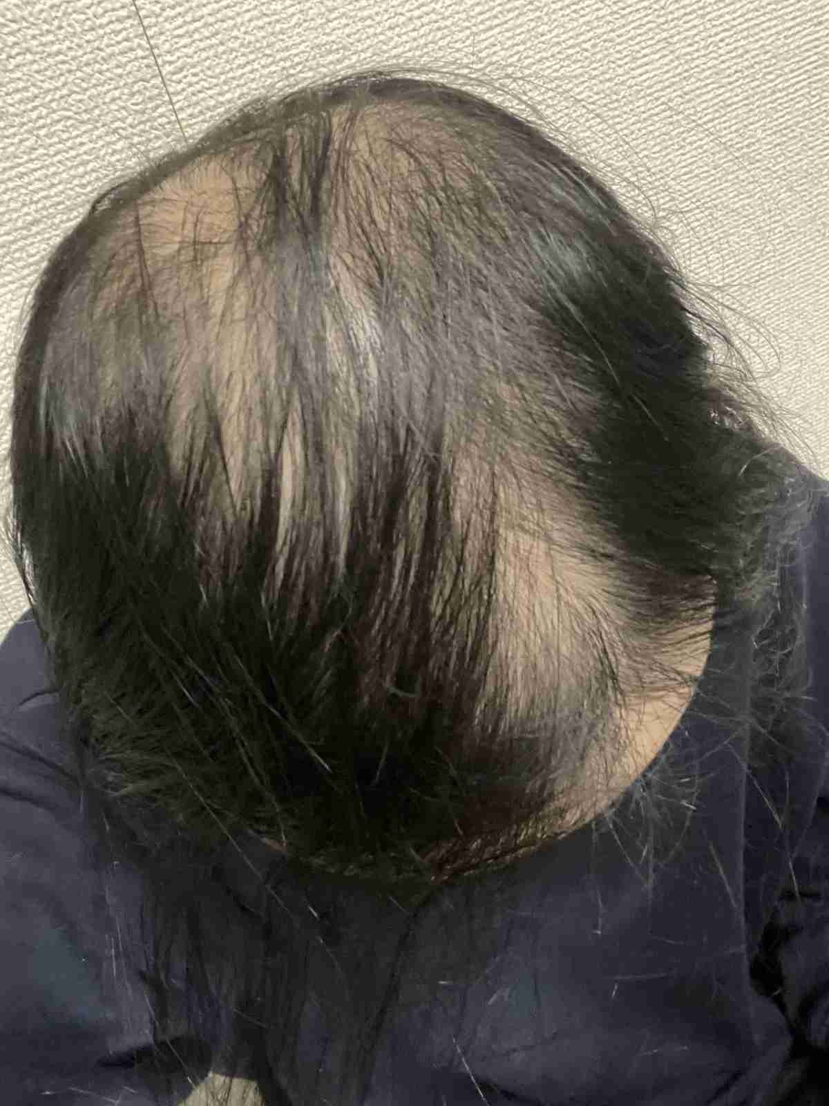 レス1番の画像2