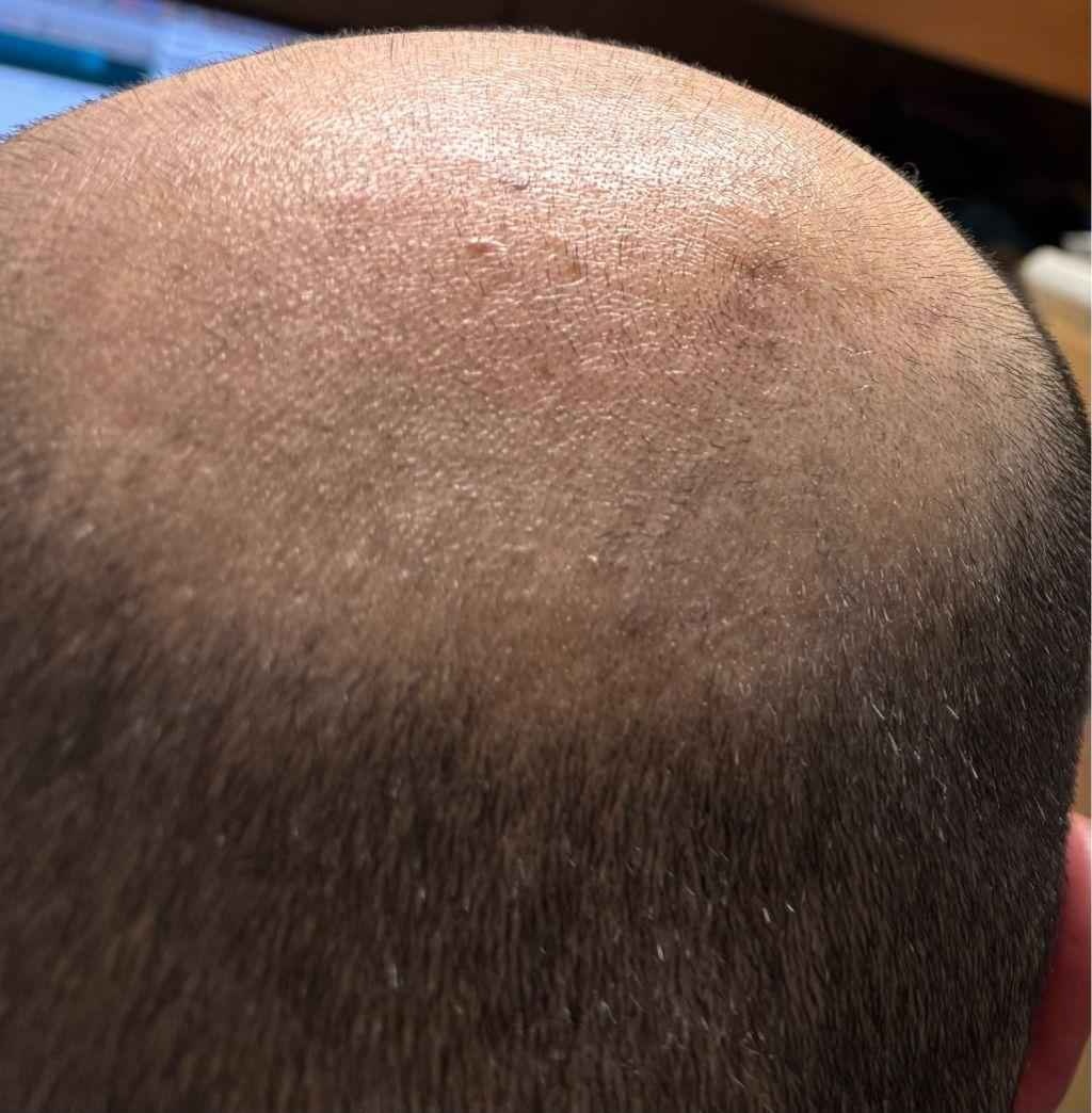 レス5番の画像1